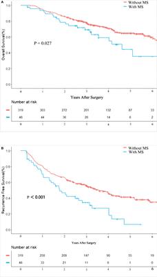 Impact of metabolic syndrome on the long-term prognosis of patients with hepatitis B virus-related hepatocellular carcinoma after hepatectomy